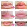 Lip gel mask - anti-rynka - fuktkräm - kollagen fläckar - 5 - 7 - 10 bitar