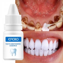 Teeth Whitening Serum - Gel - Oral hygien - tandkräm
