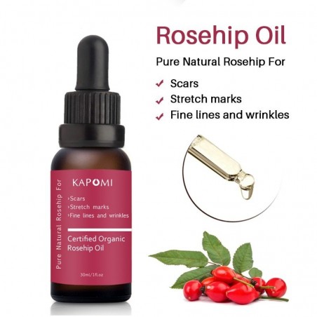 Rosehip essential oil - moisturizing / scar repair / anti-wrinkle / acne treatmentSkin