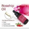Rosehip essential oil - scar repair / skin care / acne treatment - 10ml