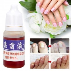 Kinesisk medicin - nagelreparation för onykomykos - nagelsvamp - 10 ml