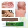 Psoriasis cream - dermatitis - eczema - anti-itch - herbal antibacterial ointmentSkin