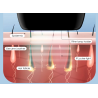 Laser epilator - permanent hårborttagning - IPL - 900000 - 5-växlar