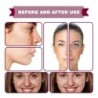 Face serum - fruit acid essence - AHA - BHA - acne treatment - whitening - 30mlSkin