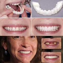 Silicone teeth cover - denture 2 piecesMouth